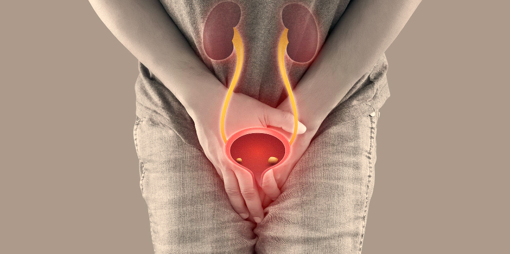Uretritis.jpg